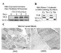 Fig 1: Mirk localizes in the cytoplasm of differentiating C2C12 myoblasts and Mirk restriction to the cytoplasm  persists in adult human skeletal muscle. 