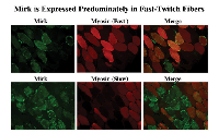Fig 3:  Mirk is expressed predominantly in fast-twitch fibers in adult human muscle. 