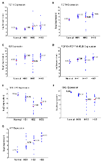 Figure 5:  Expression of FGF19, FGFR4, β-Klotho (KLB), SULT2A1, KNG1, and α-fetoprotein (AFP) in HB1, HB2,  and HB3 hepatoblastoma tumors and normal liver samples.  