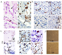 Figure 4:  Endothelial differentiation in mullerian epithelial cell-derived xenografts. 