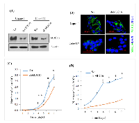 Figure 1: MUC16 knockdown alters in capan-1 and colo-357 PDAC cell proliferation. 