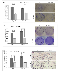 Figure 2:  MUC16 expression loss decreases colony formation and migration of PDAC cells. 