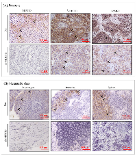 Figure 4:  Immunohistochemical analyses of MUC16 and metastatic markers in primary and metastatic sites of colo- 357 xenografts. 