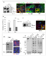 Figure 5:  MUC16 interact with mesothelin and galectin-3 in PDAC cells. 