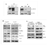 Figure 6:  Novel interaction of MUC16 with FAK and activates its downstream signaling in PDAC cells. 