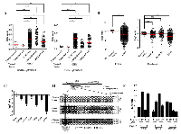 Figure 1: GNG4 is hyper methylated and down regulated in GBM. 