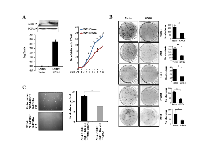 Figure 2:  Effect of GNG4 ectopic overexpression in GBM cell lines. 