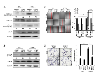 Figure 4:  Effect of GNG4 on CXCR4/SDF1α signaling and GBM cell migration. 