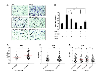 Figure 5:  Importance of CXCR4 downstream pathways in regulation of GBM cell migration. 