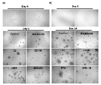 Figure 1: MCF-7 cells grown in 3-dimensional method of mammospheres, treated with E2 or BPA with or without  melatonin. 