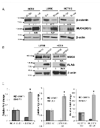 Figure  2:  Knockdown  (KD)  of  β-catenin  induces  MUC4  expression. 