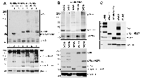 Figure 2:  The expression and activity of Ron receptor isoforms in primary tumors and high-grade serous ovarian  (HG-SOC) PDXs. 