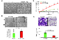 Figure 4:  The effects of sfRon expression in OVCAR3 cells in vitro. 