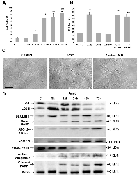Figure 1: Amitriptyline reduces HepG2 cell viability. 