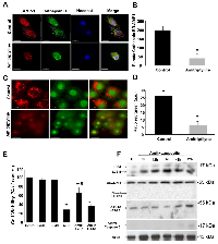 Figure  2:  Lysosomal  permeabilization  detection  by  immunofluorescence. 