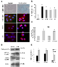 Figure 3:  Autophagic markers in Amitriptyline-treated cells. 