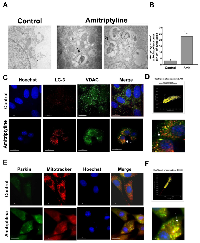 Figure 4:  Mitophagy in Amitriptyline-treated cells. 