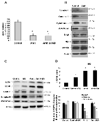 Figure 5:  Mitophagy and autophagic flux in Amitriptyline-treated cells. 