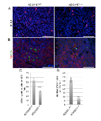 Figure 5:  ADAM17 deletion in the hematopoietic compartment leads to reduced proliferation in developing tumors. 