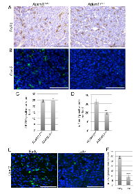 Figure 6:  ADAM17 deletion in the hematopoietic compartment leads to reduced Cox-2 expression in developing  tumors. 