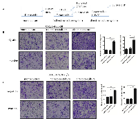 Figure 1: The migration and invasion abilities of CD133+ liver cancer cells (including CD133+ Hep-3B and CD133+  PLC/PRF/5) were enhanced when added to the direct co-cultured supernatants. 