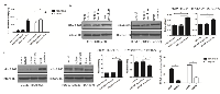 Figure 3:  CXCL9 expression was upregulated in direct co-cultured supernatants through the activation of NF-kB. 