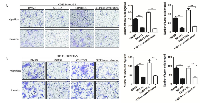 Figure 4:  The migration and invasion abilities of CD133+ liver cancer cells attracted by the direct co-cultured  supernatants decreased when the direct co-culture groups were pretreated with MG132 or the supernatants were  pretreated with CXCL9 neutralizing antibody. 