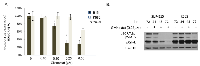 Figure 1: Antiproliferation effect of Givinostat on leukemia cell lines. 