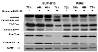 Figure 4:  Activation of apoptotic cascade by Givinostat on leukemia cell lines. 