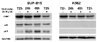 Figure 6:  Detection of expressions of CHK1, p53, and p21 in leukemia cells. 