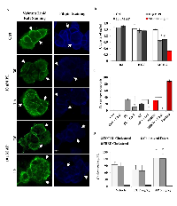 Figure 2:  AP disrupts lipid rafts and modulates cholesterol levels in vitro  and in vivo . 