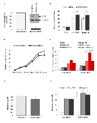 Figure 4:  CETP  contributes to cancer cell growth and survival and is upregulated in breast cancer patients. 