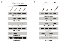 Figure 1: Cellular levels and localization of β-catenin and ABC are altered by loss of PTEN. 