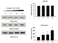 Figure  4:  Wnt  3A  alters  cellular  levels  of  β-catenin  independent  of  ABC. 