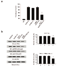 Figure 6:  Cellular levels and activity of PP2A phosphatase is altered by re-expression of PTEN in A2058 cells. 
