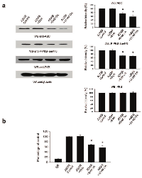Figure 7:  Inhibition of PP2A activity with okadaic acid decreases cellular ABC levels. 