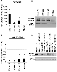 Figure 1: Expression levels of PDGFRB in Mero-14, IstMes2, and Mero-25 human MPM cell lines and Met5A. 