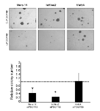 Figure 4:  Role of PDGFRB in anchorage-independent growth capacity following siPDGFRB transfection. 