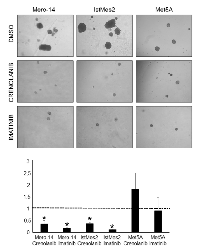 Figure 8:  Role of PDGFRB in anchorage-independent growth capacity following drugs inhibitors treatments. 