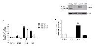 Figure 2:  Differential expression of STEAP1, STEAP1B1 and STEAP1B2 on prostate cell lines. 