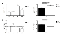 Figure 4:  Effect of serum on PNT1A (A- upper left and right) and LNCaP (B- lower left and right) STEAP1 mRNA and  protein stability, after treatment with Act D and Chx, respectively. 
