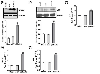 Figure 1:  Expression of SPARC in D283 medulloblastoma cells. 