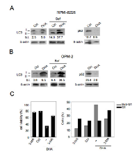 Figure  3:  DHA  enhances  autophagy  in  MM  cells,  which contributes to DHA-induced cell death. 