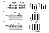 Figure 6:  DHA inhibits STAT3 pathway in MM cells, PBMCs and DCs. 