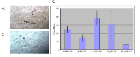 Figure 1: Anchorage independent growth in soft agar of transfected cell lines. 