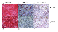 Figure 3:  Changes in multilineage differentiation capacity in hMSC-TSR and pOB-TSR. 