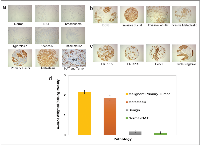 Figure 1: Representative immunohistochemistry images showing TAB004-HRP staining (brown) in human breast  tissues.  (a) 