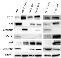 Figure 2:  A Western Blot of HCC827 and H1975  parental and drug-resistant sub-lines characterisation. 