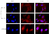 Figure 3:  An immunocytochemistry staining showing the localization of YAP in drug-resistant sub-lines. 