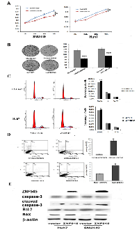 Figure 1: ZNF545 suppresses cell proliferation, induces G1/S arrest and induces cell apoptosis in human HCC cells. 